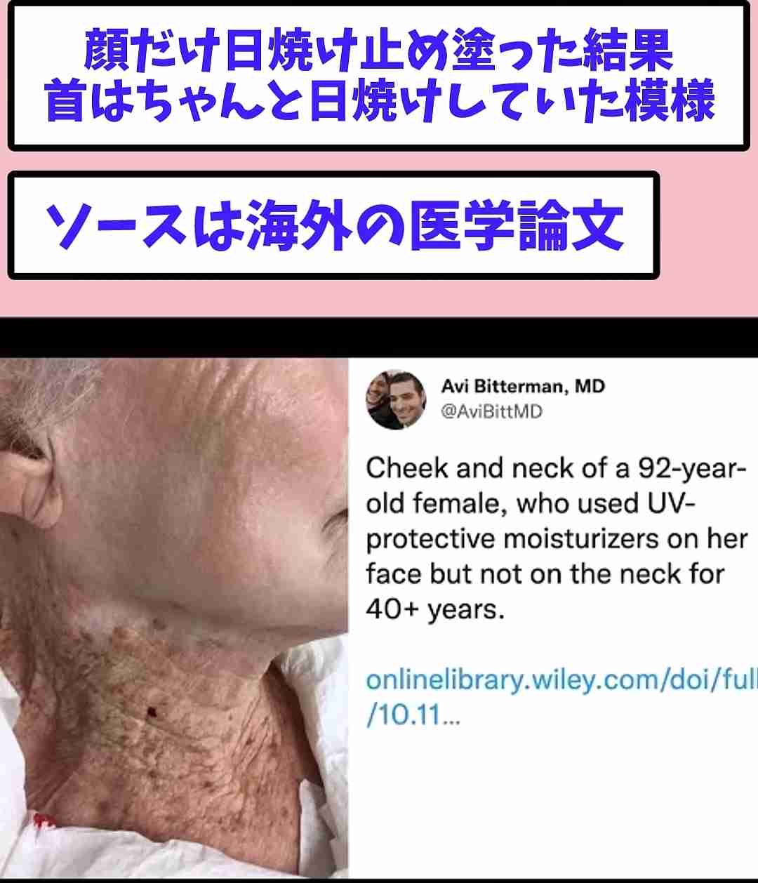 オカリナ 41歳、体の変化に悲鳴 「お金かけても取り返しつかない」「予防が一番大事」切実訴え