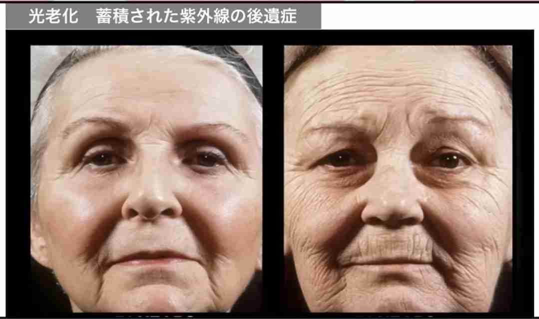 オカリナ 41歳、体の変化に悲鳴 「お金かけても取り返しつかない」「予防が一番大事」切実訴え