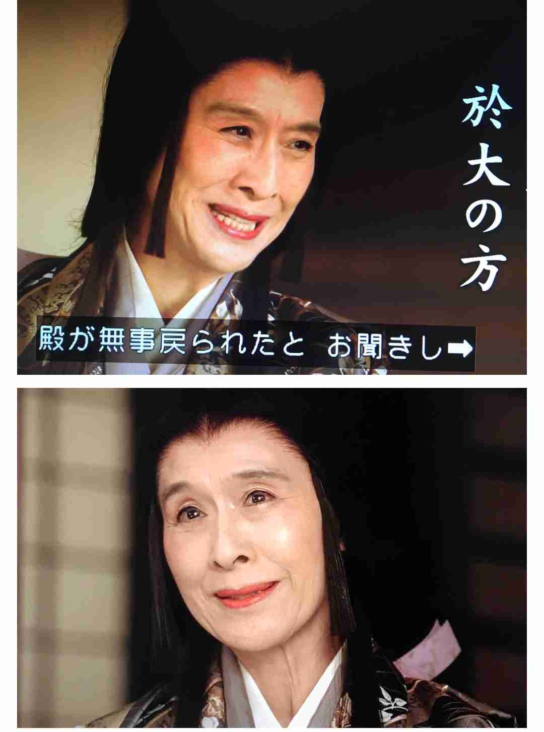 鼻の穴が大きいのが悩み
