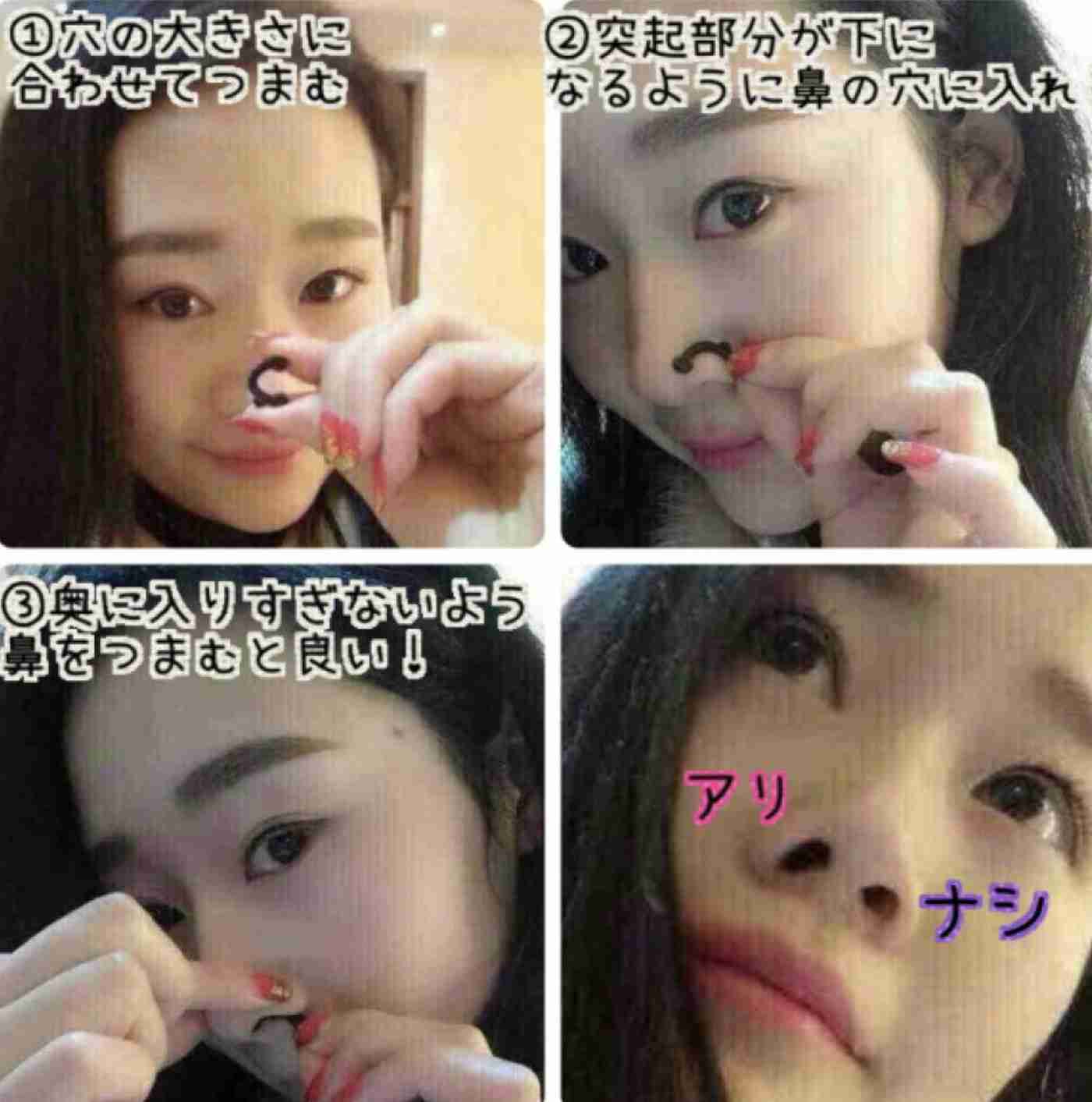 鼻の穴が大きいのが悩み