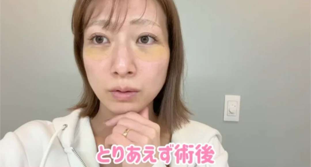 クマ取り手術したことある人に聞きたい