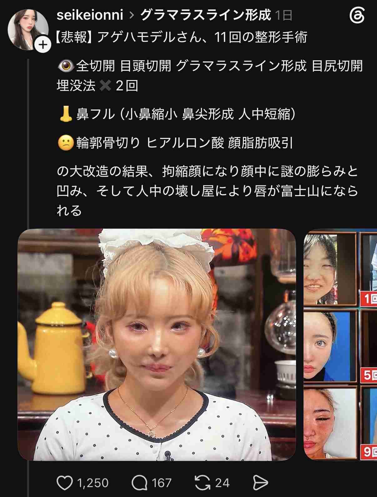 ルッキズム昭和と令和どっちが酷い?
