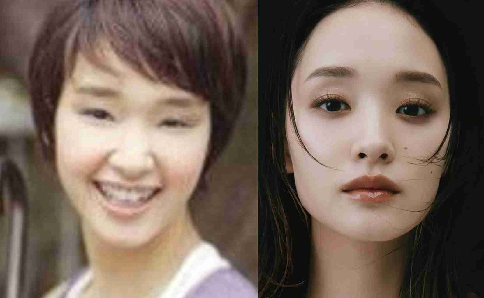 ブスから美人になった人