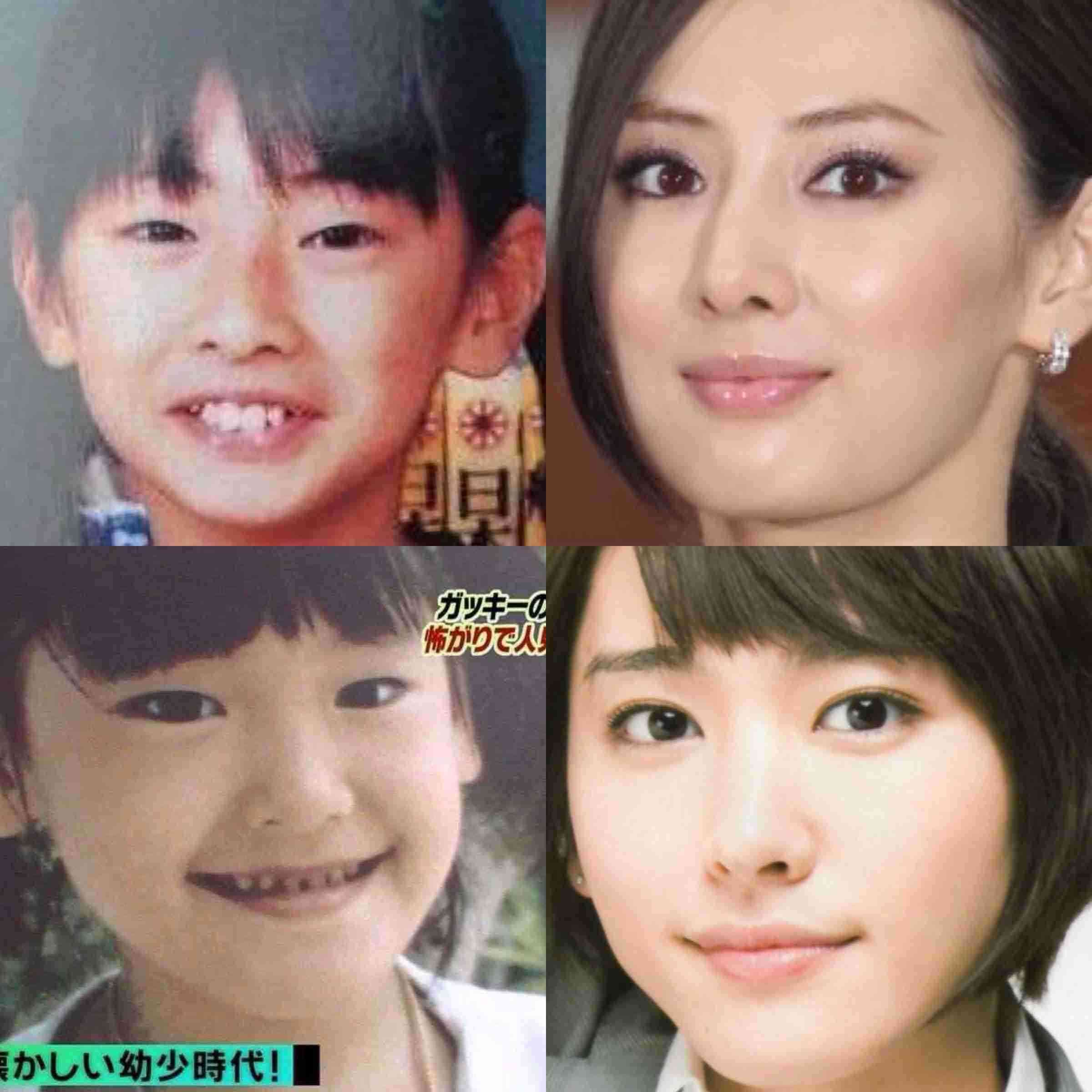 ブスから美人になった人