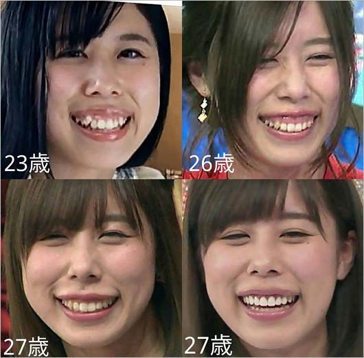 有村架純さん好きな方【アンチ厳禁】