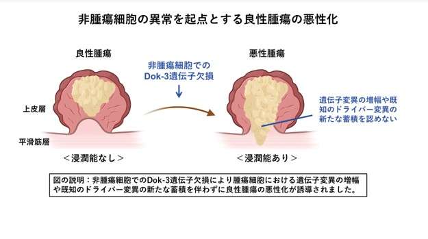 良性腫瘍