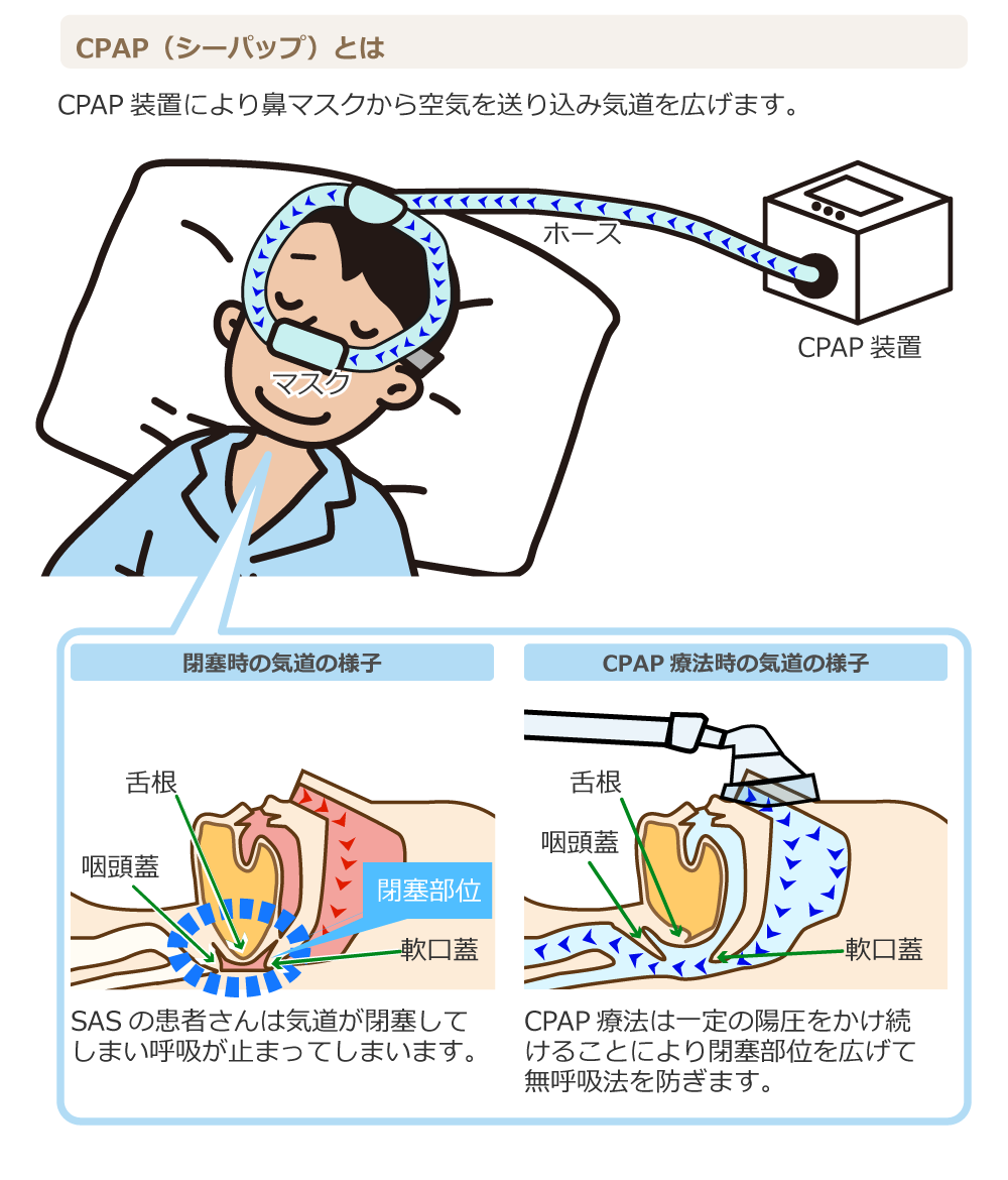 いびき対策について語りたい