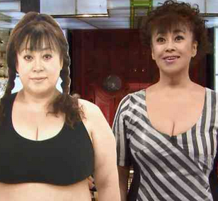 ダイエットが一番の整形って本当ですか?