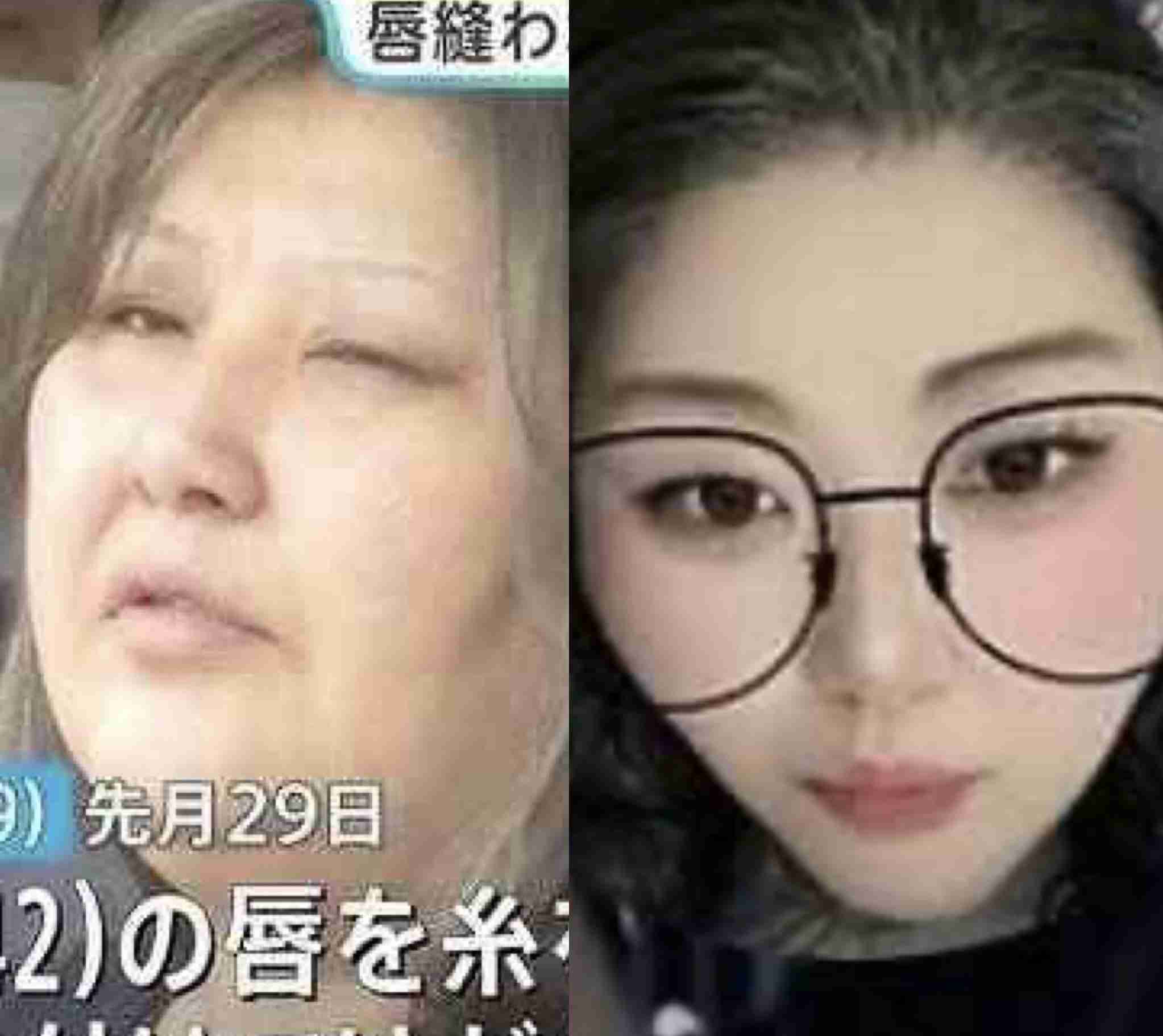 《同居女性の唇を糸で縫いつけ》正座して「痛い、痛い」と言いながら自ら針を…元交際相手が見た花柄タトゥー女(49歳)に“監視された生活”「言いつけを守らない、直さないと」冬に屋外に閉め出し