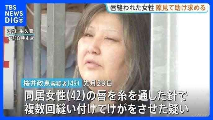 《同居女性の唇を糸で縫いつけ》正座して「痛い、痛い」と言いながら自ら針を…元交際相手が見た花柄タトゥー女(49歳)に“監視された生活”「言いつけを守らない、直さないと」冬に屋外に閉め出し