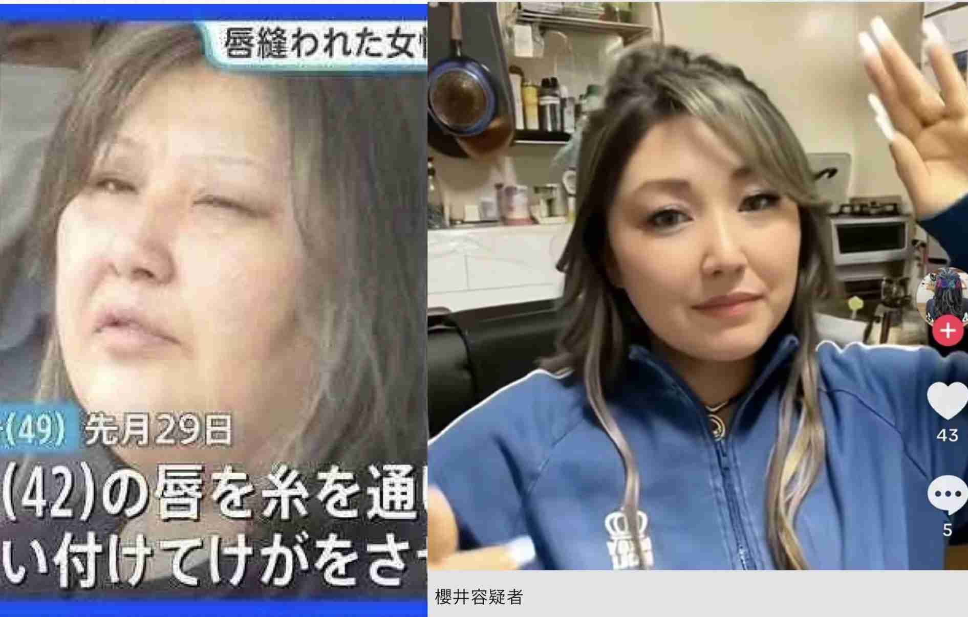 《同居女性の唇を糸で縫いつけ》正座して「痛い、痛い」と言いながら自ら針を…元交際相手が見た花柄タトゥー女(49歳)に“監視された生活”「言いつけを守らない、直さないと」冬に屋外に閉め出し
