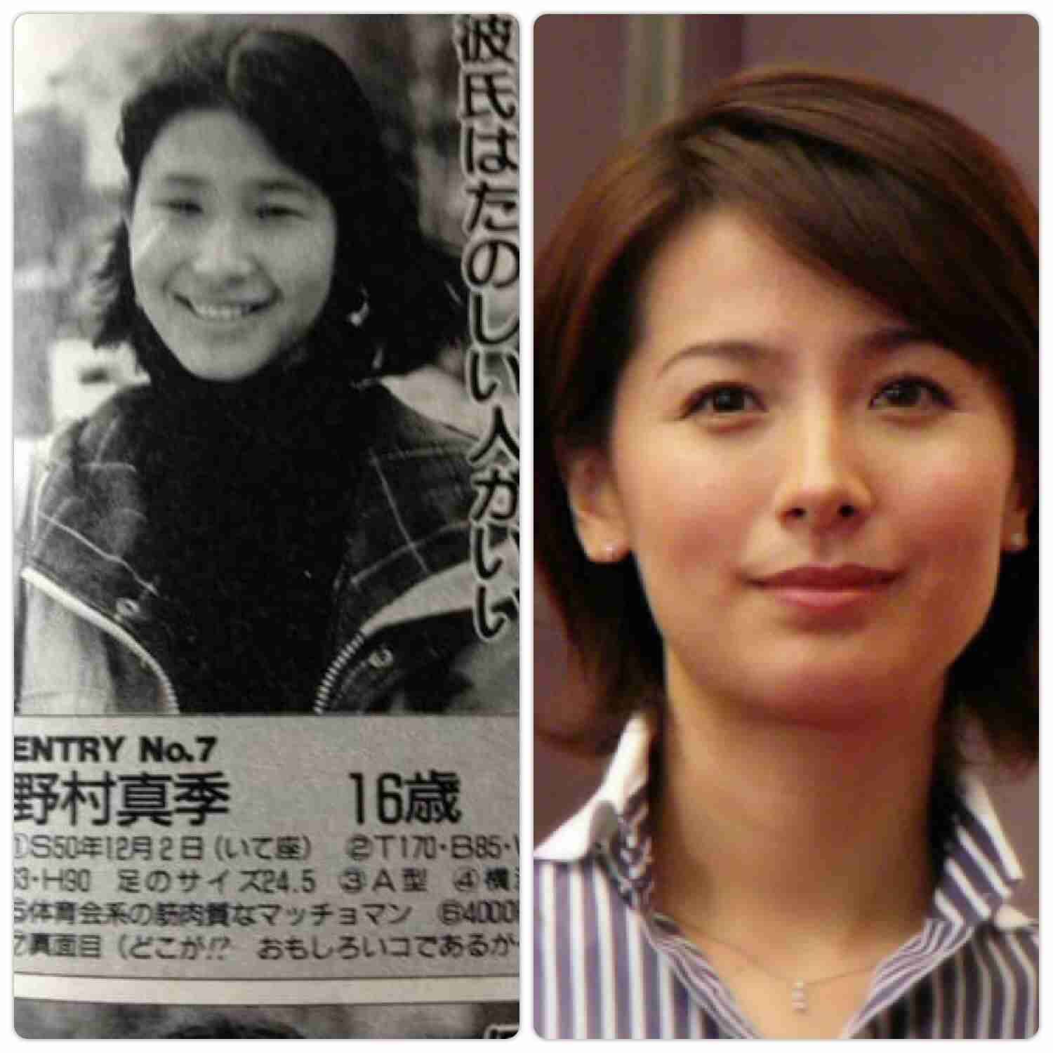 鼻の整形について語りたい