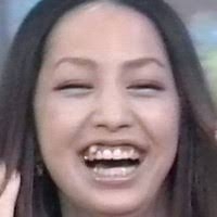 歯列矯正の歯科選び