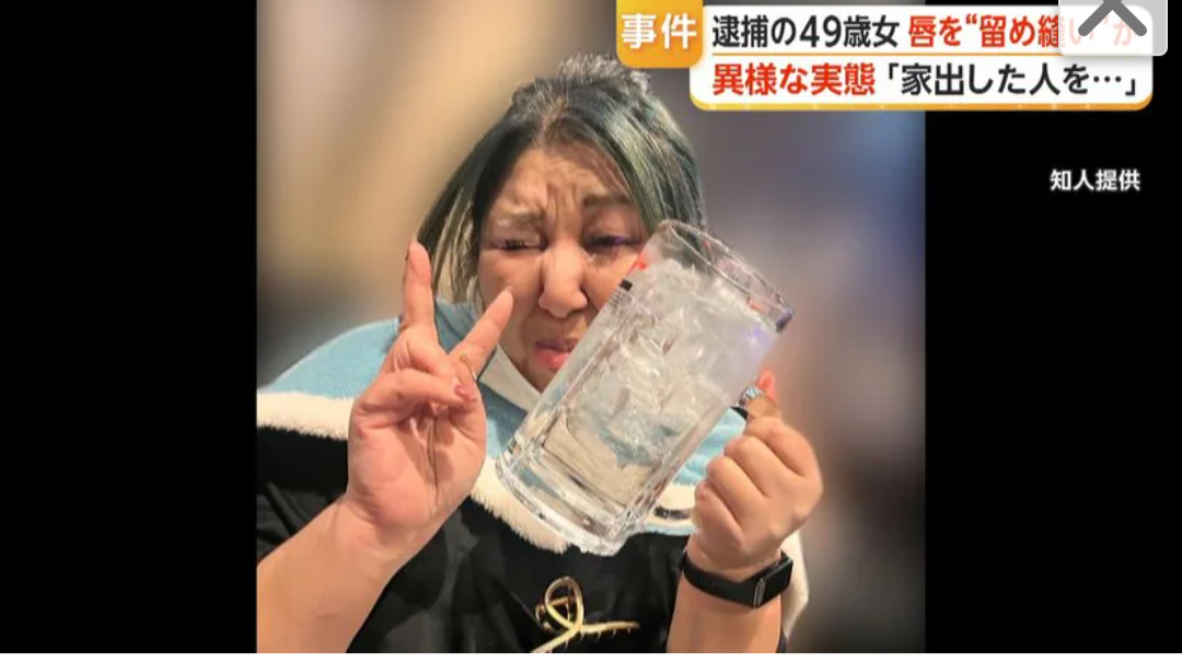 鼻の下から下唇の下までを口の中に糸を通す形で縫われる 女性の唇を縫い付け49歳女が逮捕された事件 茨城・古河市