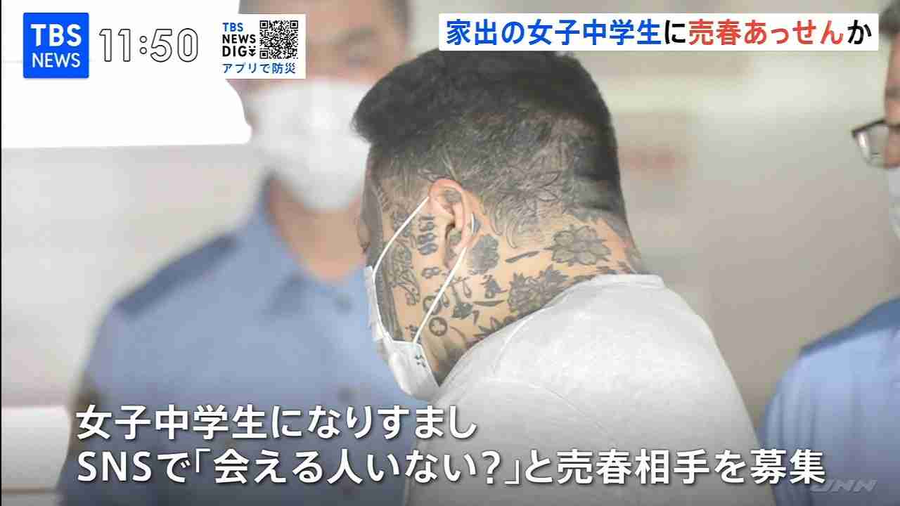 鼻の下から下唇の下までを口の中に糸を通す形で縫われる 女性の唇を縫い付け49歳女が逮捕された事件 茨城・古河市