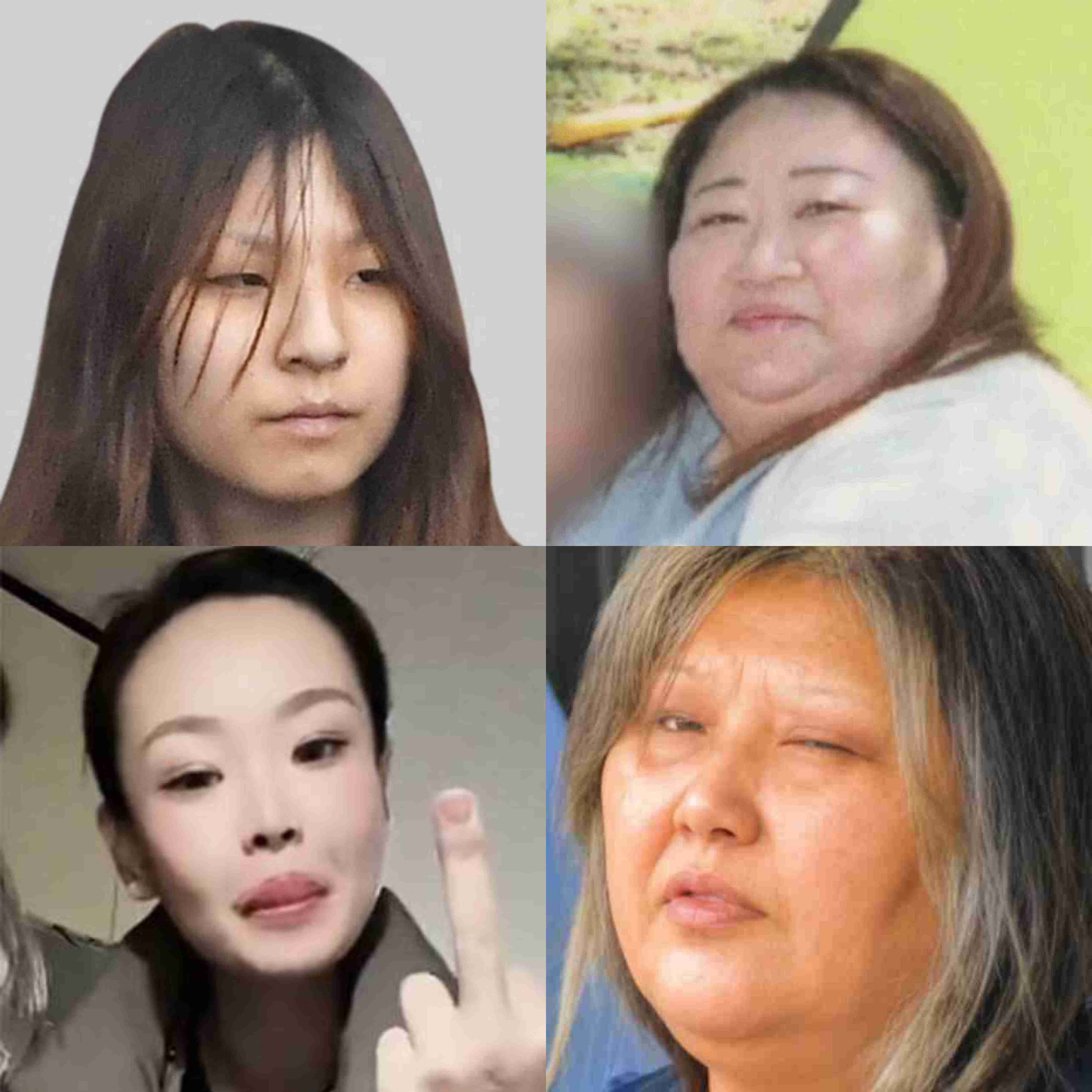 鼻の下から下唇の下までを口の中に糸を通す形で縫われる 女性の唇を縫い付け49歳女が逮捕された事件 茨城・古河市