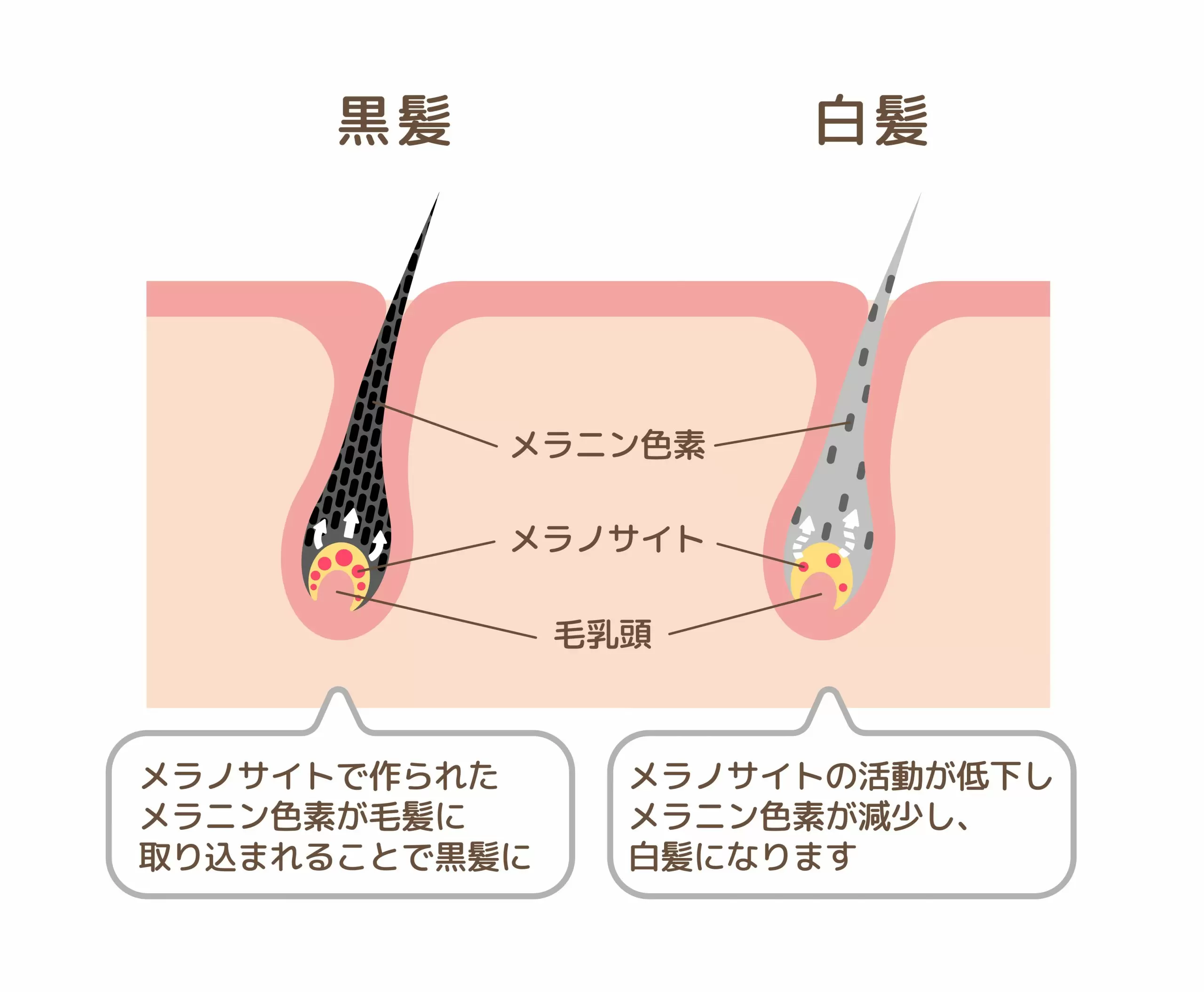白髪染め、面倒くさい