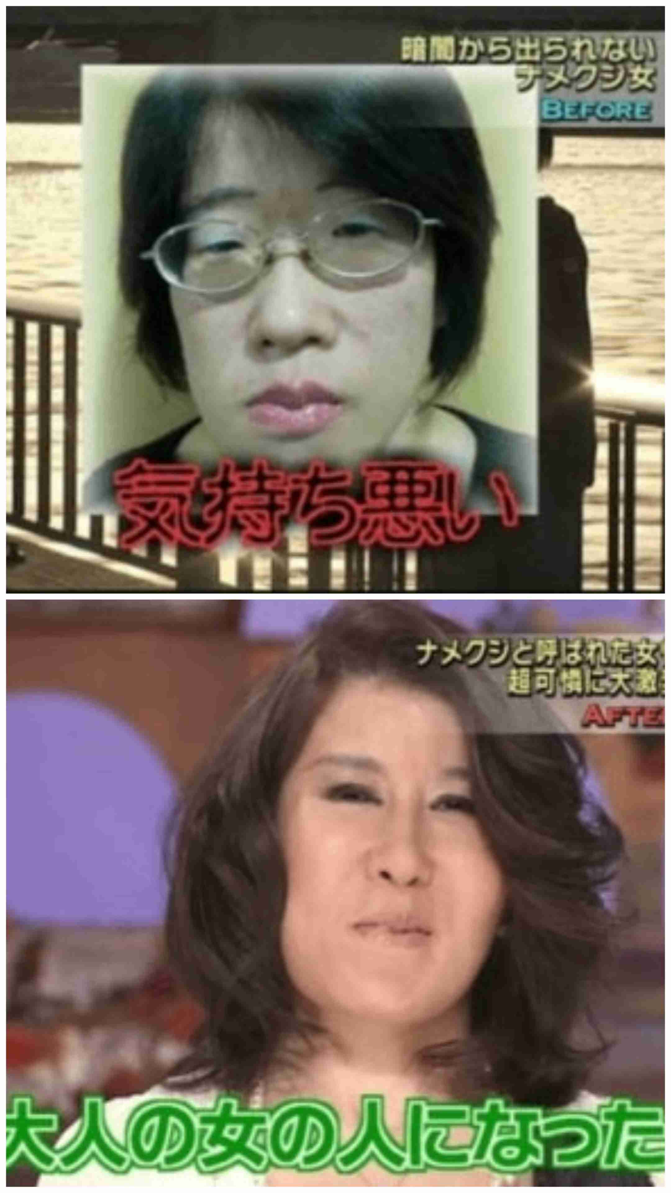 「ブスだといじめに」「整形で幸せになるなら」「したら縁を切る」…“わが子の整形”に賛否両論 専門家が教える「大正解の対応」とは?