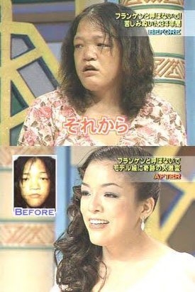 「ブスだといじめに」「整形で幸せになるなら」「したら縁を切る」…“わが子の整形”に賛否両論 専門家が教える「大正解の対応」とは?