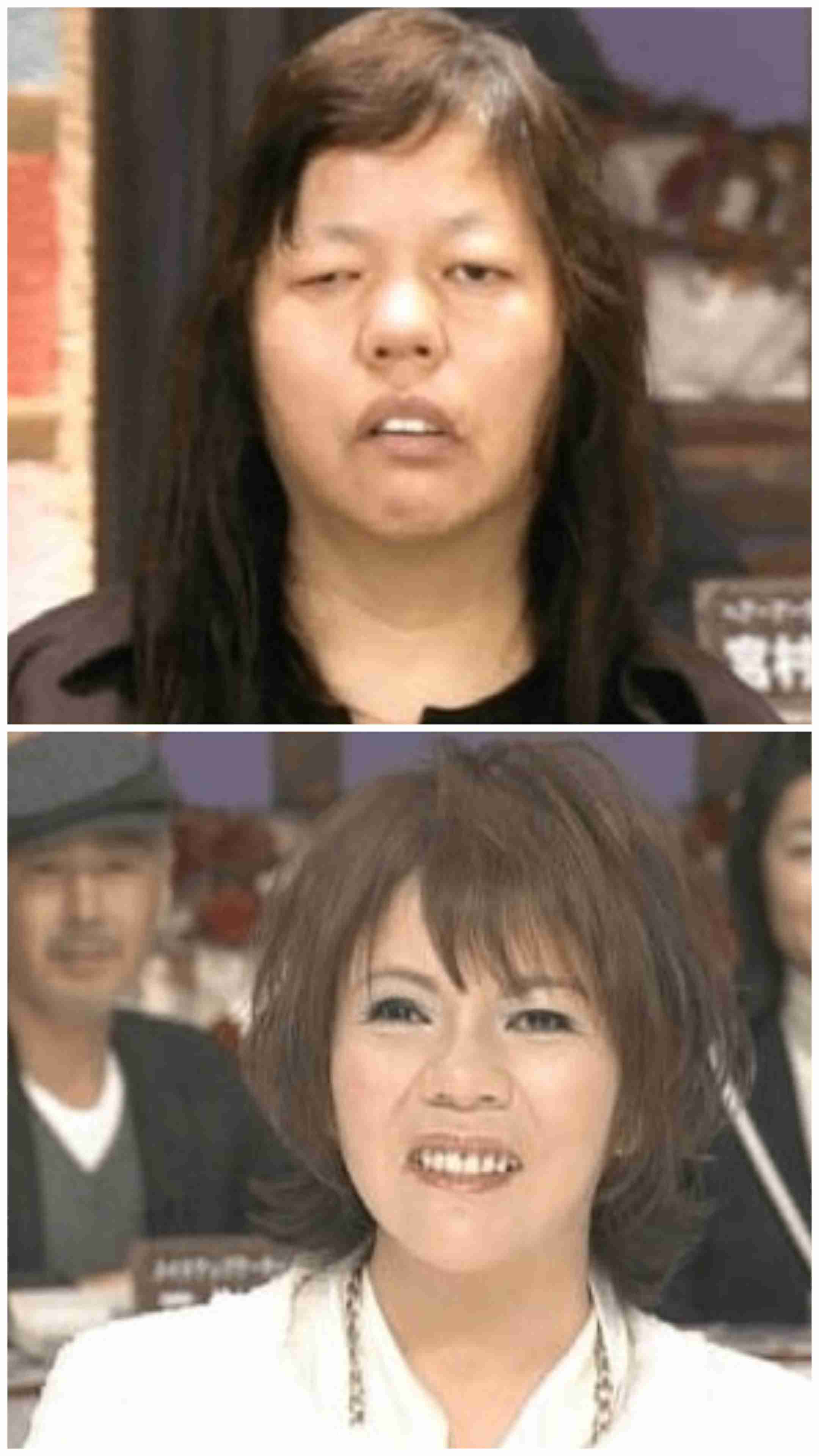 「ブスだといじめに」「整形で幸せになるなら」「したら縁を切る」…“わが子の整形”に賛否両論 専門家が教える「大正解の対応」とは?