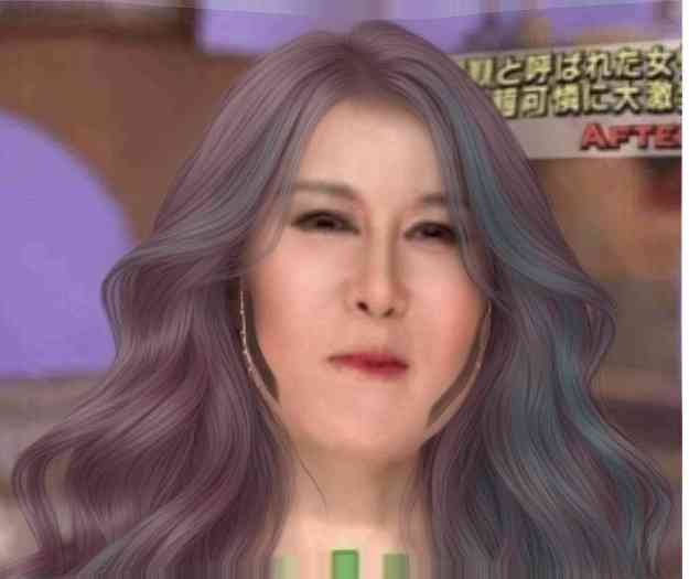 「ブスだといじめに」「整形で幸せになるなら」「したら縁を切る」…“わが子の整形”に賛否両論 専門家が教える「大正解の対応」とは?