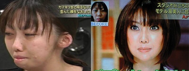 「ブスだといじめに」「整形で幸せになるなら」「したら縁を切る」…“わが子の整形”に賛否両論 専門家が教える「大正解の対応」とは?