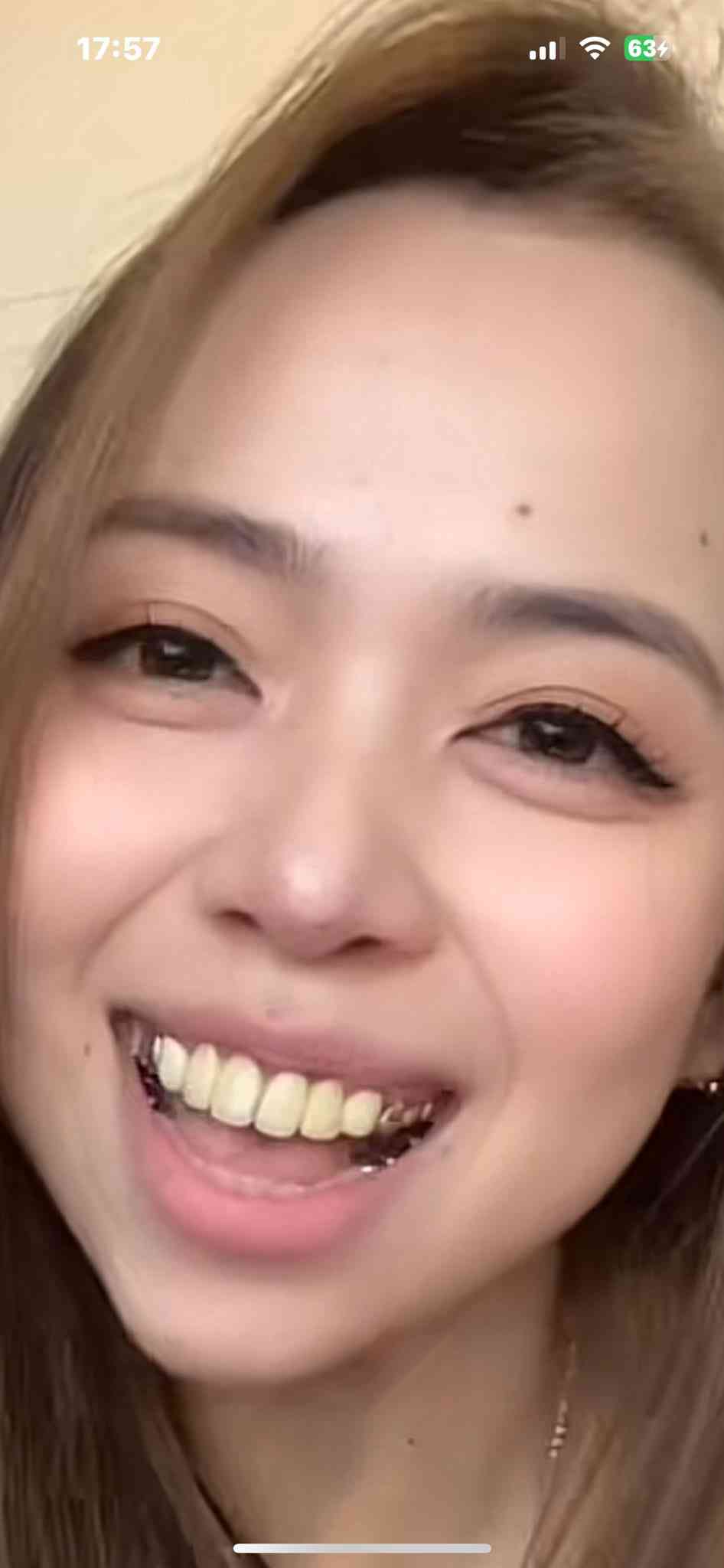 乳歯20本が全部虫歯、前歯が折れていても放置…小児専門歯科医が明かす「歯の治療をしてもらえない子どもたち」の実態