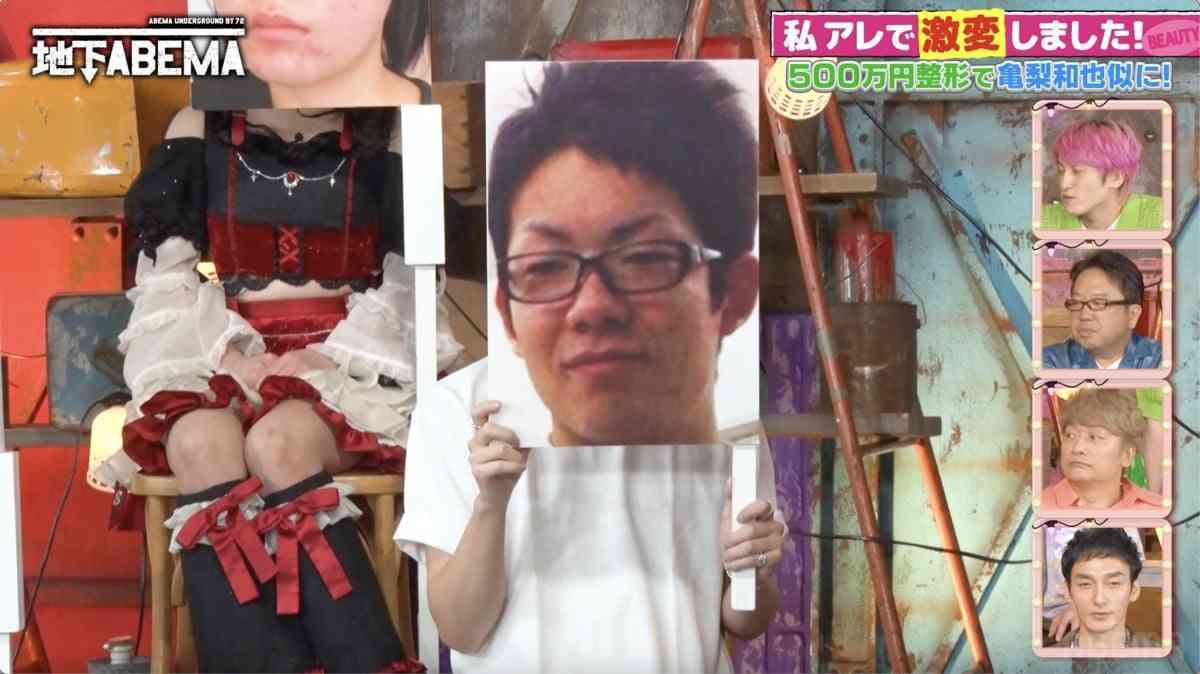 整形総額500万円で亀梨和也似に激変!きっかけは彼女の浮気&ホスト不合格