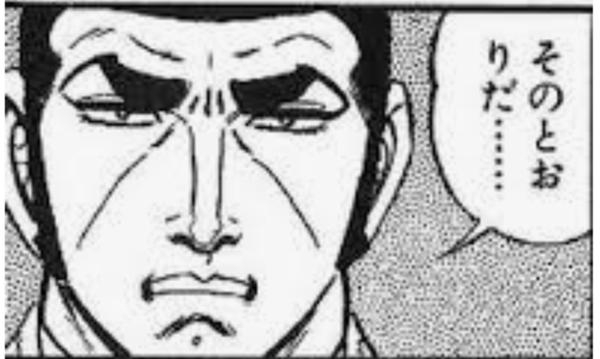 【相談】ゴルゴ線が酷すぎて辛いです。