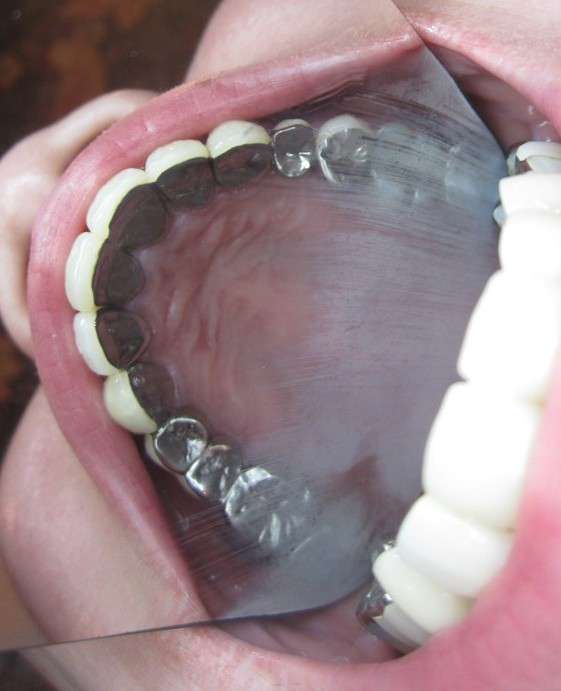 【家族の口臭鼻毛】指摘すべきか、しないべきか