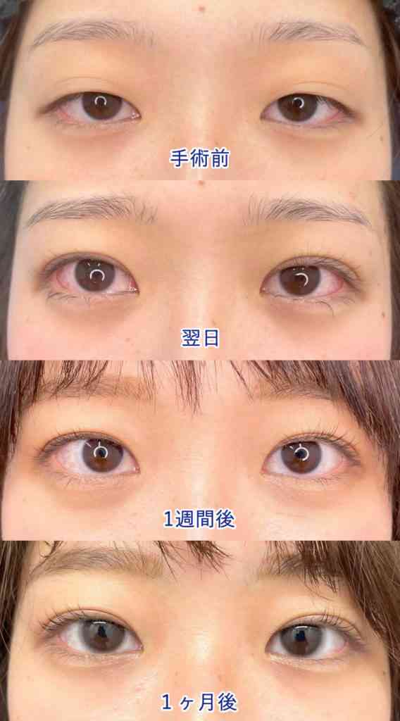 ダウンタイム中の過ごし方