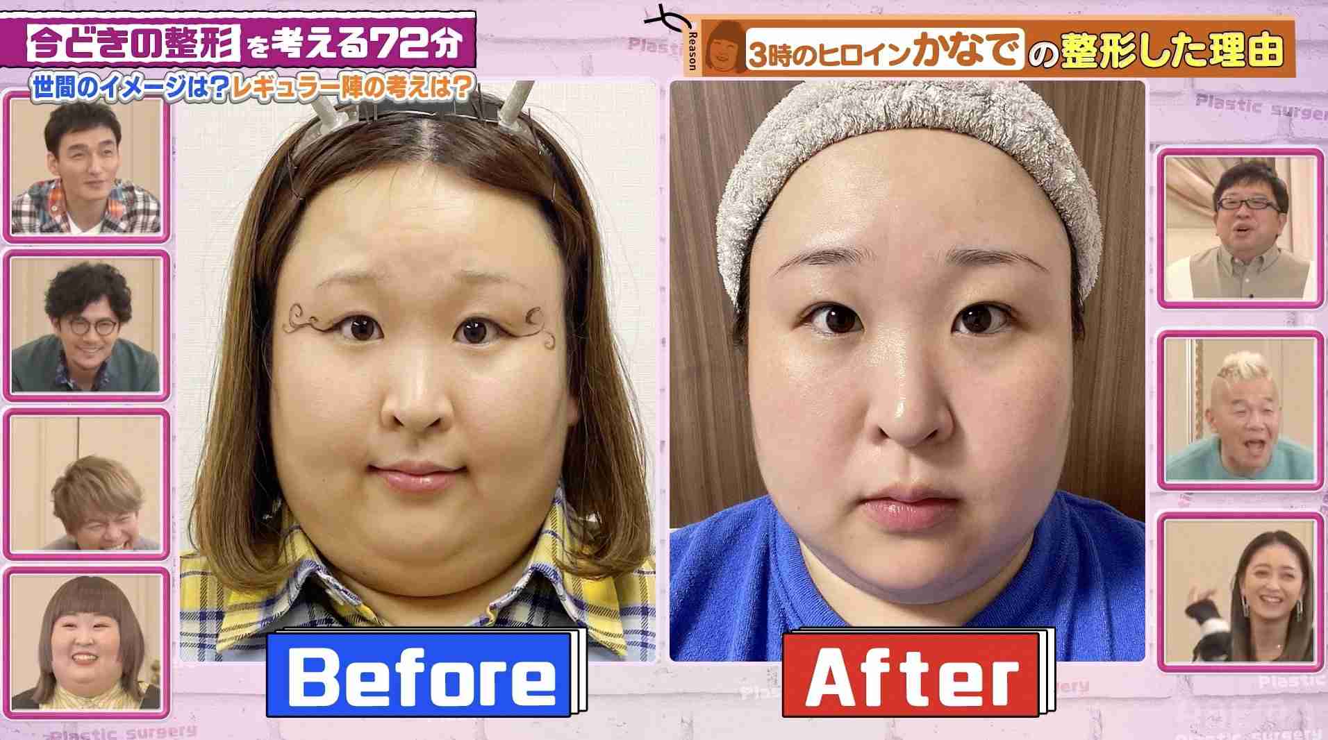 整形成功した人