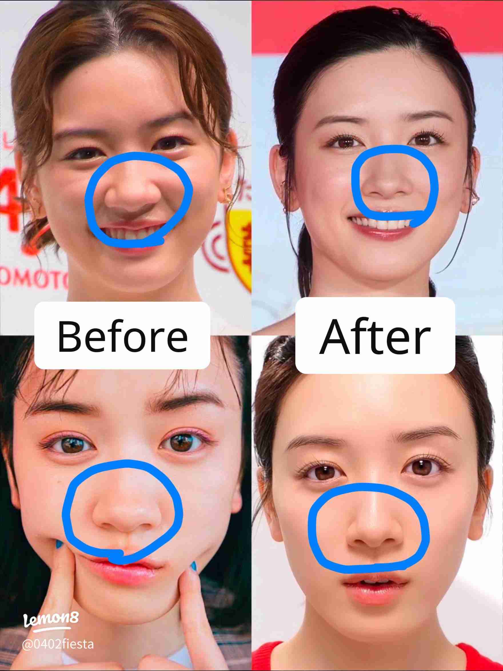 整形成功した人