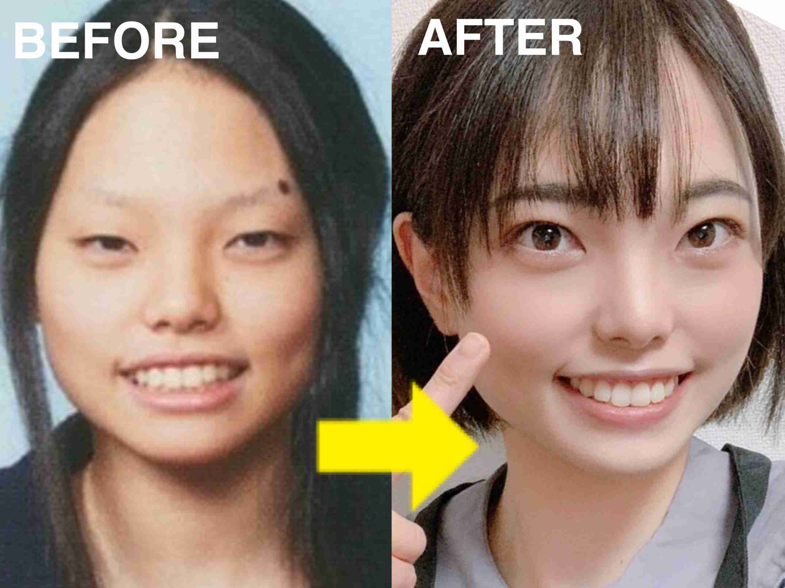 整形成功した人