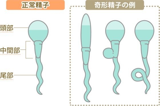 体外受精励まし合いたい