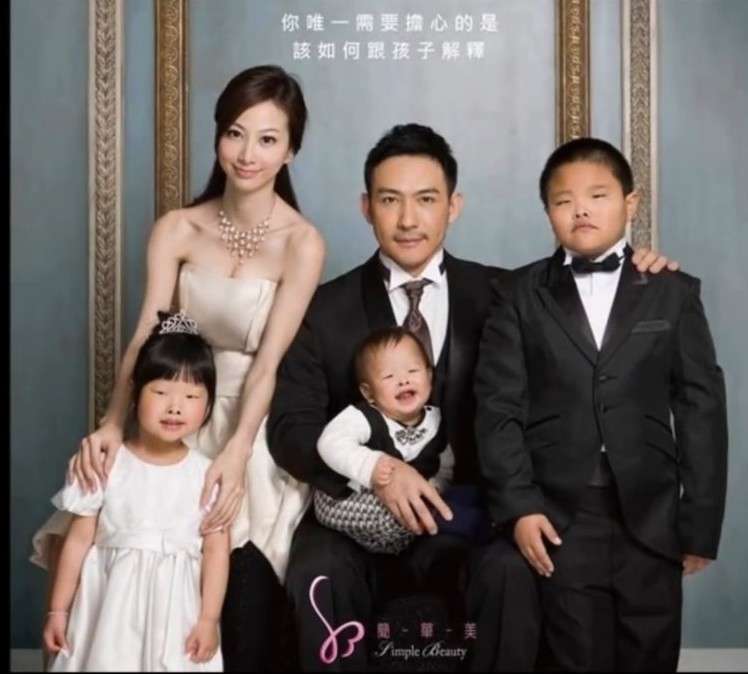 美容医療、進む低年齢化 目立つまぶた整形、親の意向も 専門家「丁寧なカウンセリングを」