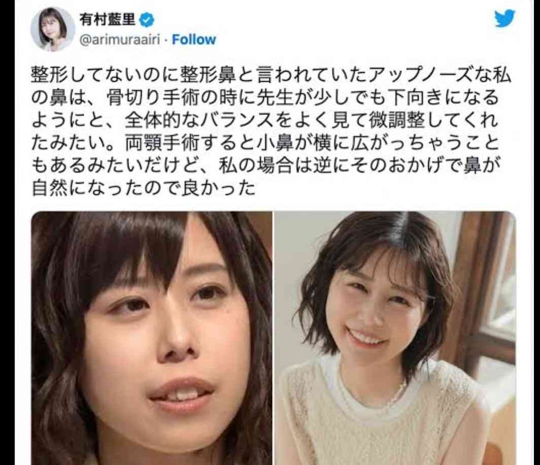 「整形は100%わかる」←嘘ですよね。