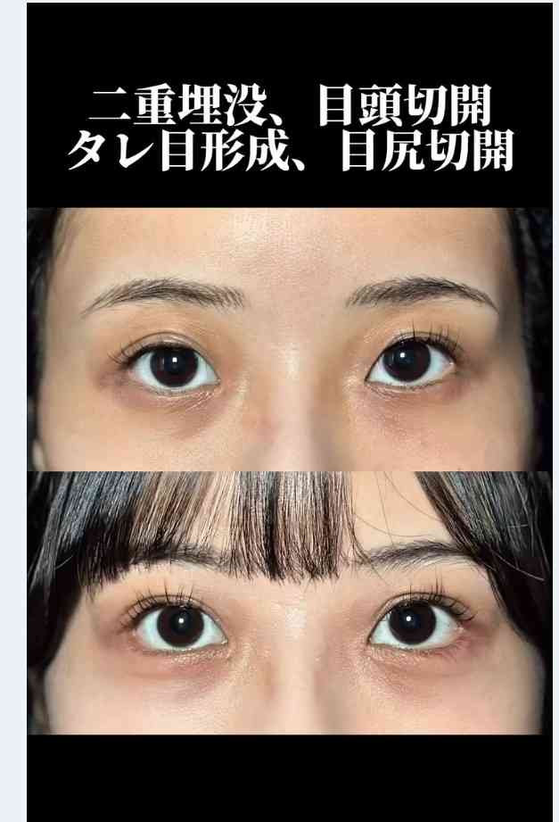 「整形は100%わかる」←嘘ですよね。