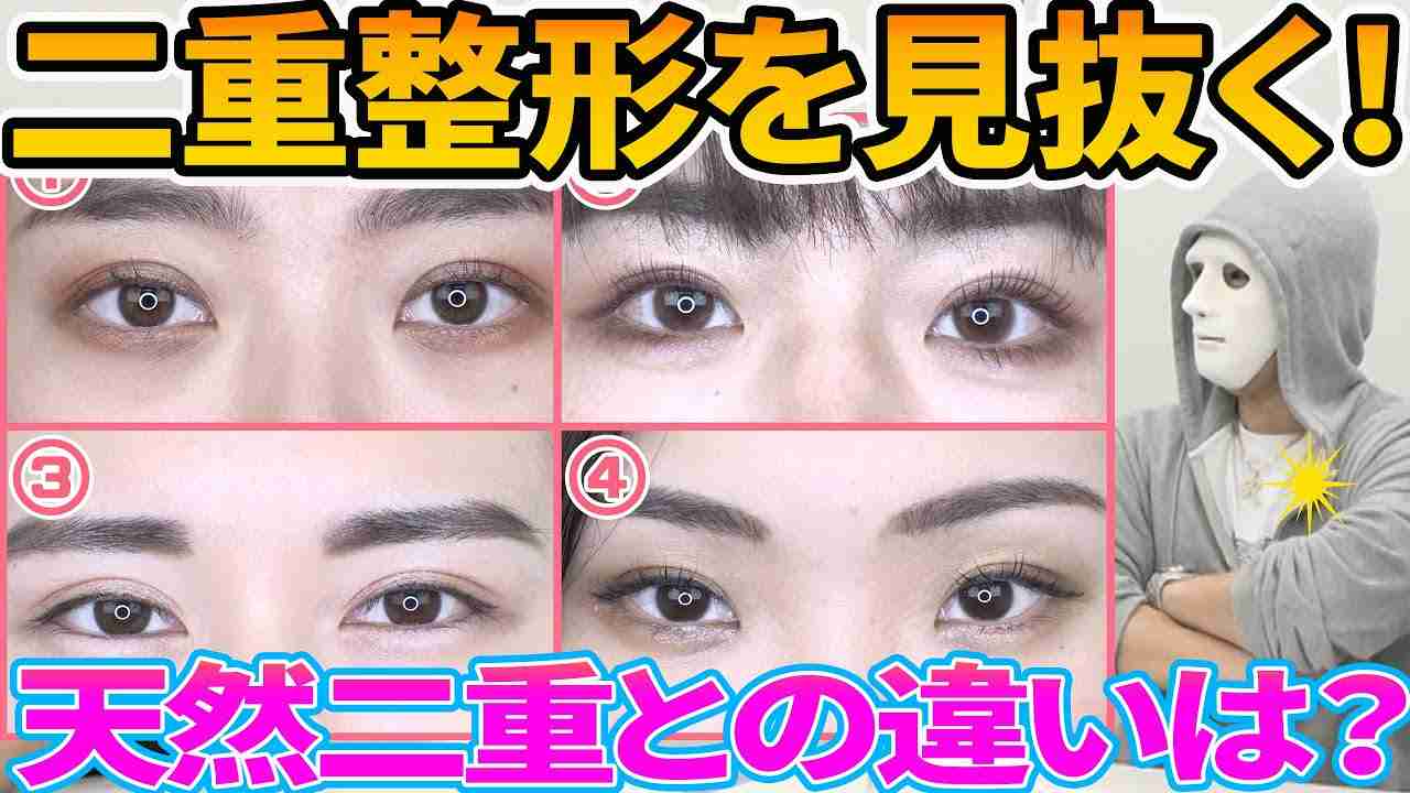 「整形は100%わかる」←嘘ですよね。