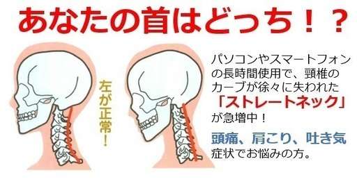 【ストレートネック?】シャンプー台等で首が痛くなる人
