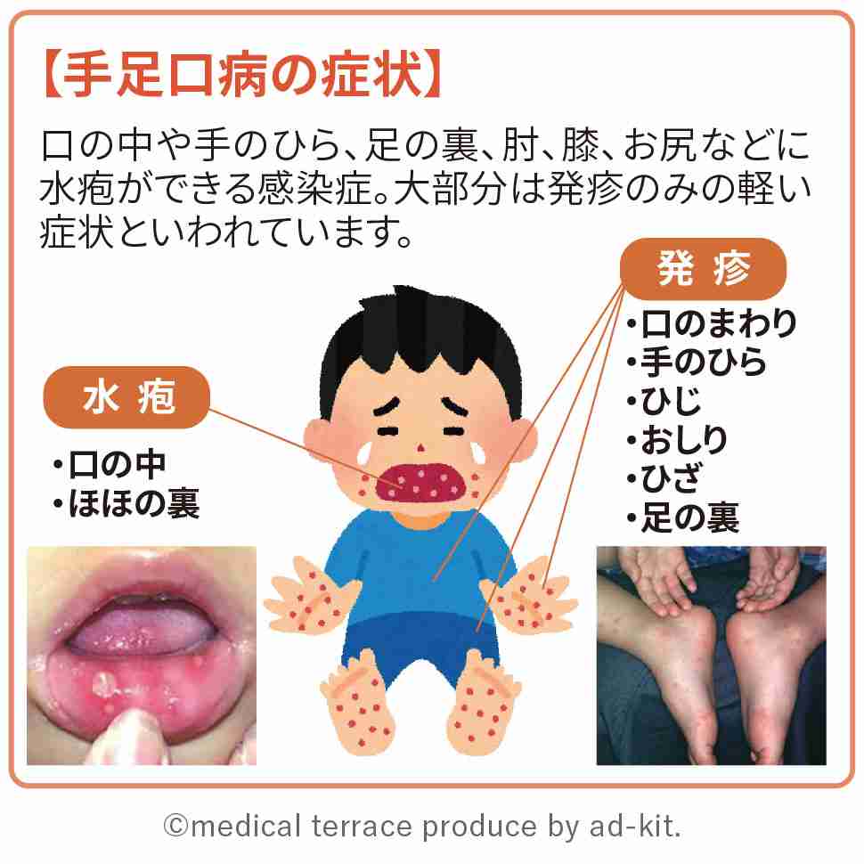 子どもの困った感染症