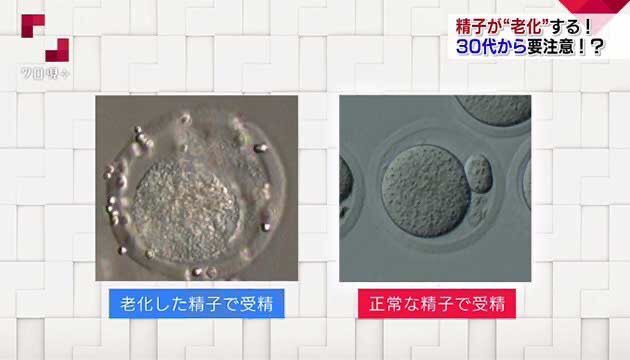 特徴的な顔つきや知的障害の子を産むのは「リスク」？ 国が進める「プレコン」に潜む問題点とは 「あってはならない恐怖として描かれている」と批判【やまゆり園事件10年】