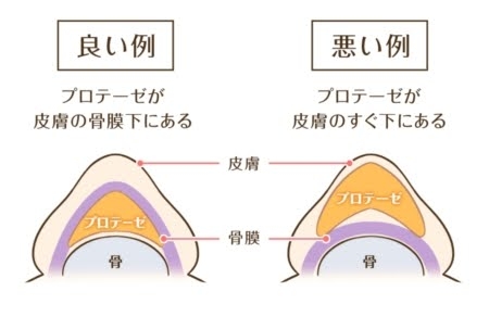 美容整形で疑問に思っていること