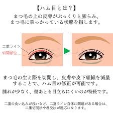 美容整形で疑問に思っていること
