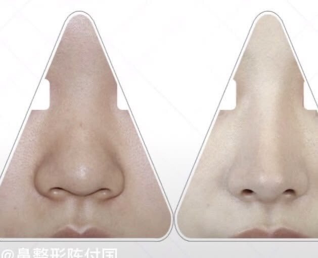 美容整形で疑問に思っていること