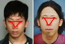 美容整形で疑問に思っていること