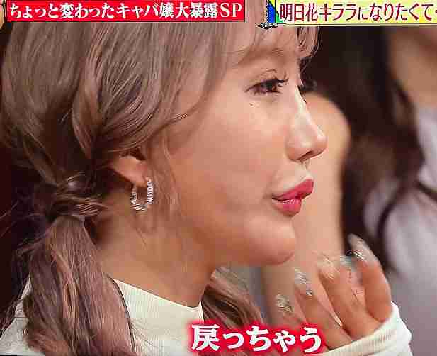 「もう元の顔が…」過去に整形告白…明日花キララ〝別人級〟ショット「昔のイメージと違いすぎて」「痩せすぎなんじゃ？」「一番流行りな顔」
