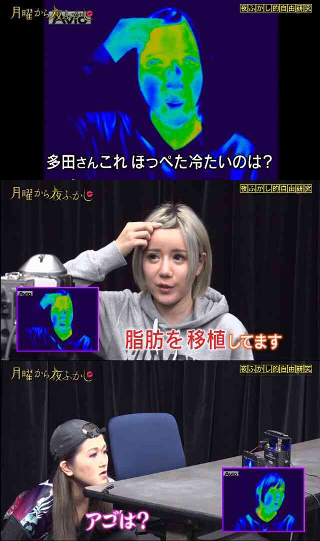 「もう元の顔が…」過去に整形告白…明日花キララ〝別人級〟ショット「昔のイメージと違いすぎて」「痩せすぎなんじゃ？」「一番流行りな顔」