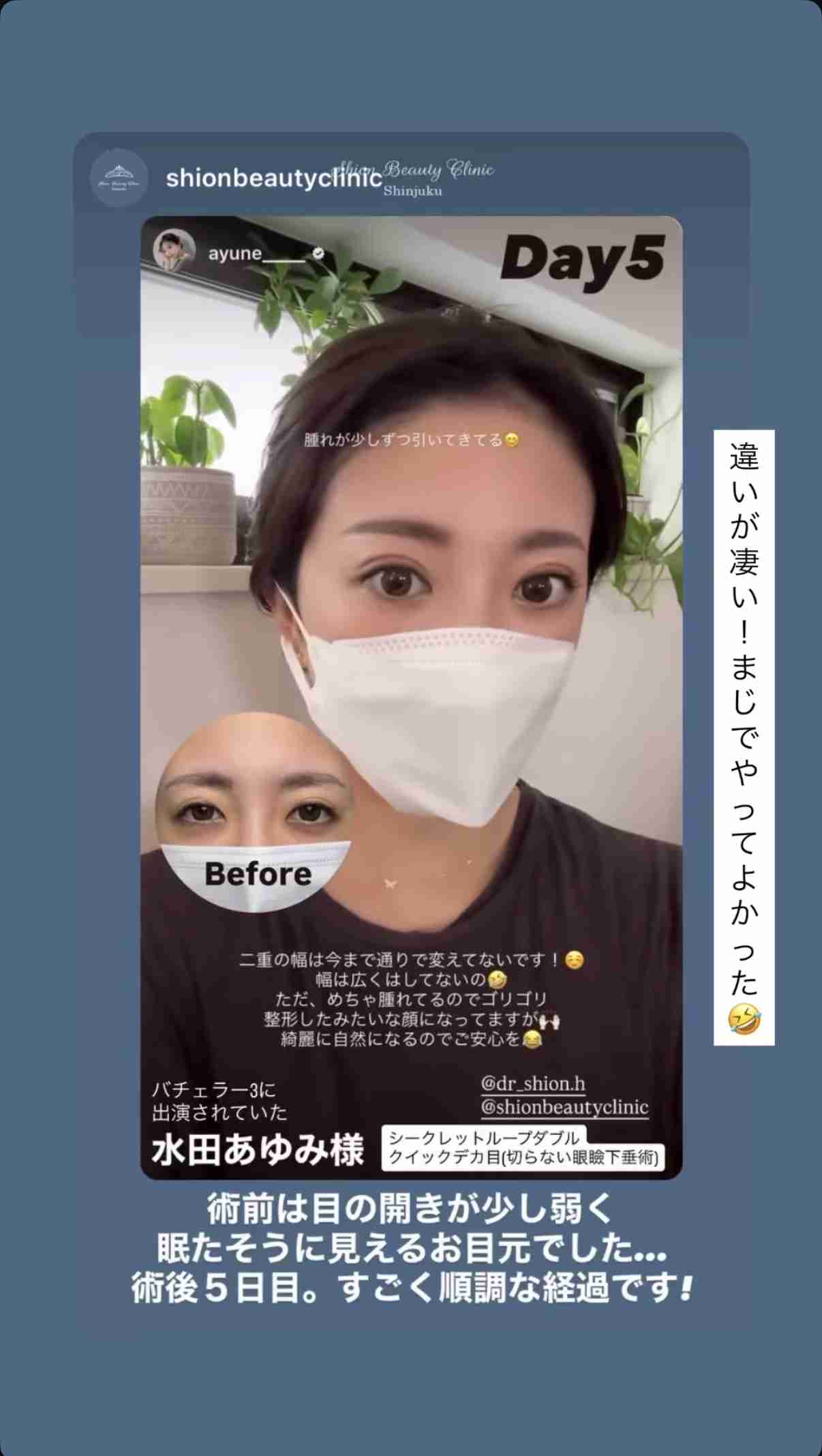 ある日急に似合わなくなった服