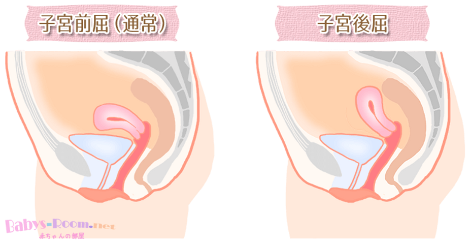 骨ストは可愛い妊婦さんになれないのか